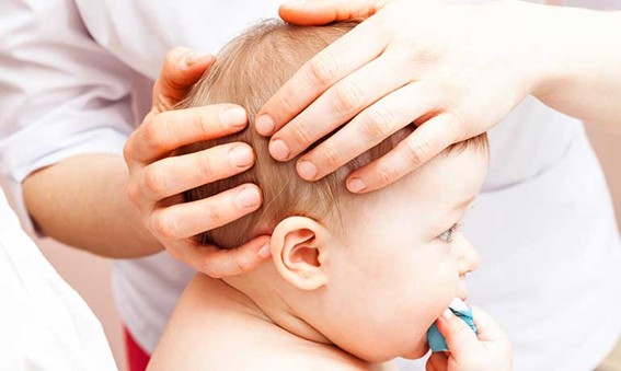 Plagiocefalia postural: qué debo saber